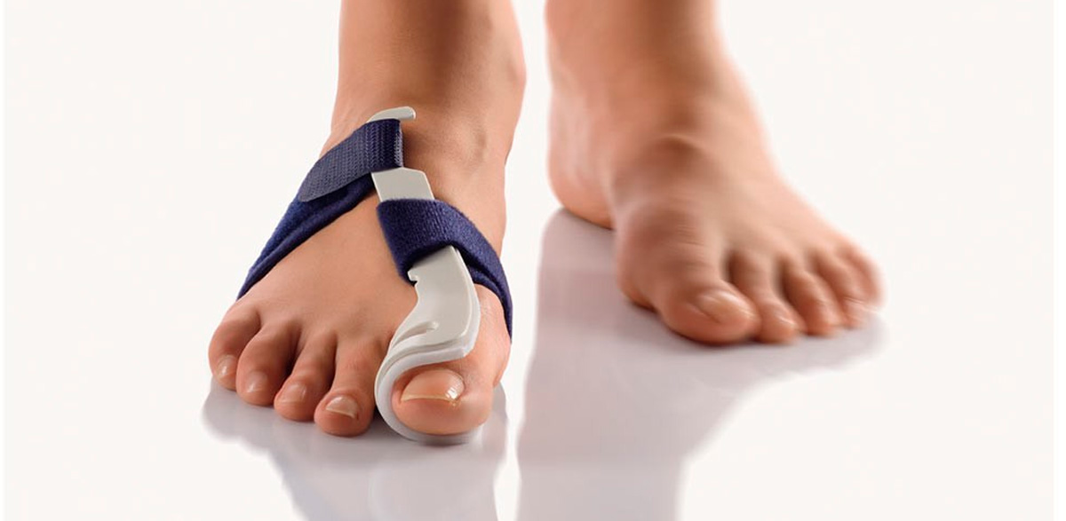 Hallux Valgus